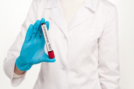 Tisztifőorvos: szombattól a Magyarországra érkező fizeti a PCR-teszte