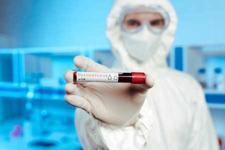 A fertőzöttek száma 34,8 millió, a halálos áldozatoké 1,03 millió a világon