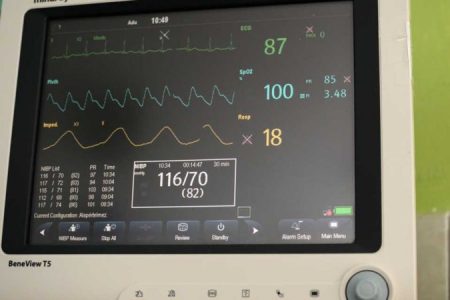 10 betegőrző monitort küld az állam a vajdasági Zentára